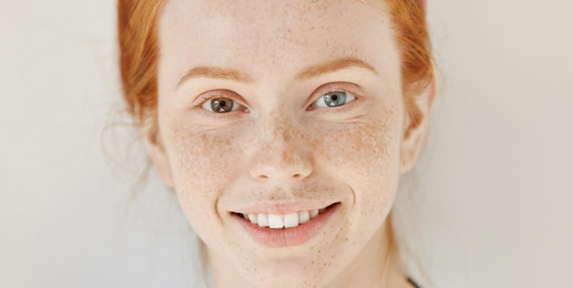 hyperpigmentation-body