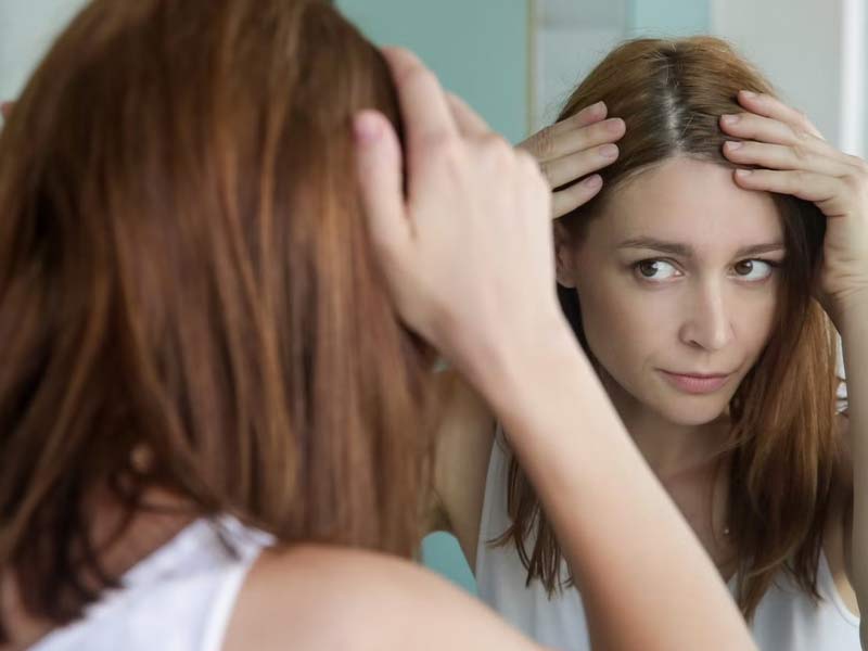 सिर में लंबे समय से डैंड्रफ हो सकता है स्कैल्प सोरायसिस का संकेत, जानें इसके कारण, लक्षण और इलाज