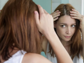सिर में लंबे समय से डैंड्रफ हो सकता है स्कैल्प सोरायसिस का संकेत, जानें इसके कारण, लक्षण और इलाज