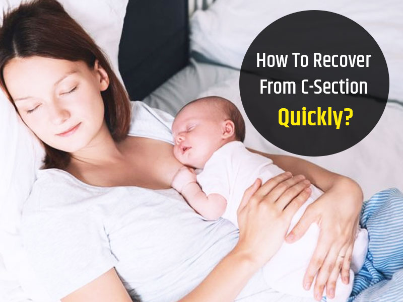 How To Quickly Recover From C-Section?