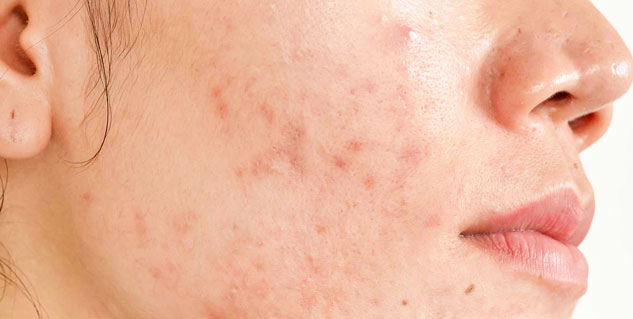 skin problems