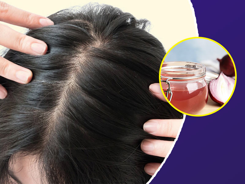 पतले बालों को मोटा और घना करने के लिए अपनाएं ये 5 उपाय 