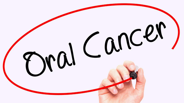 What Is Oral Cancer? Symptoms And Causes By Expert | OnlyMyHealth