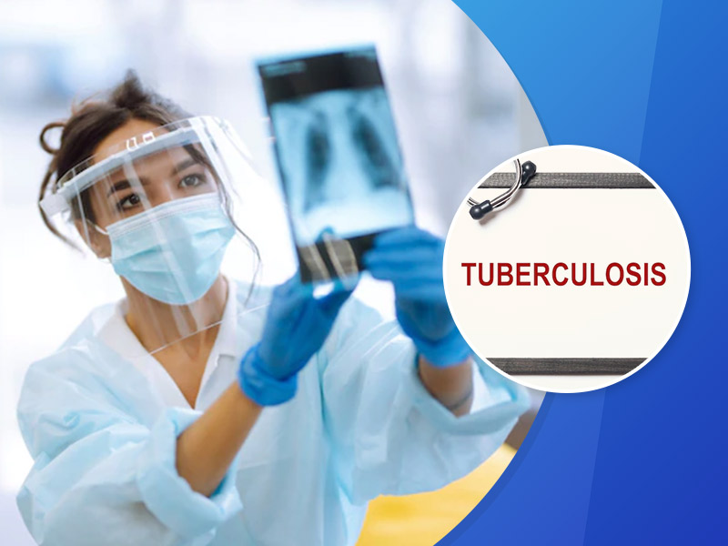 World Tuberculosis Day 2022: Here’s How Tuberculosis Test Is Done