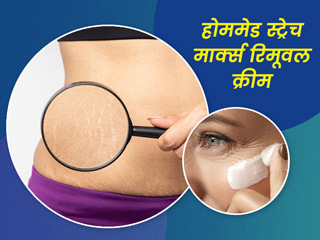 त्वचा से खिंचाव के निशान मिटाने के लिए घर पर बनाएं ये स्ट्रेच मार्क्स रिमूवल क्रीम