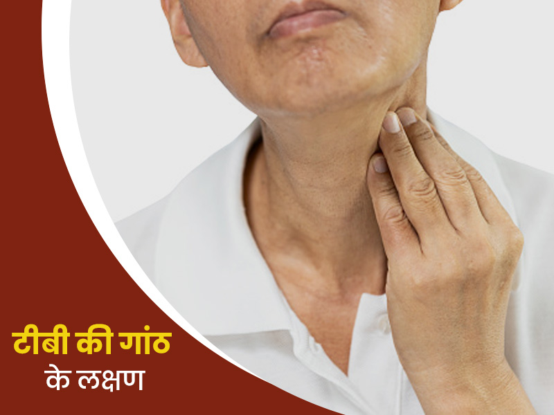टीबी की गांठ के लक्षण : लिम्फ नोड ट्यूबरक्लोसिस क्या है? जानें इसके कारण और लक्षण