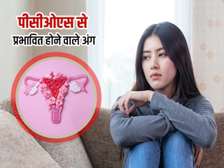 पीसीओएस (PCOS) होने पर ये 5 अंग होते हैं सबसे ज्यादा प्रभावित, जानें कैसे करें बचाव