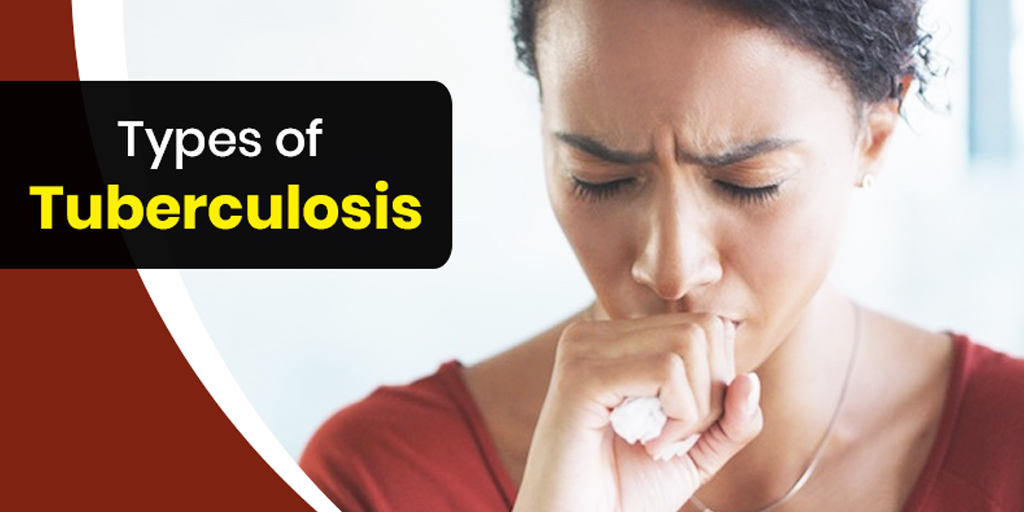 Types Of Tuberculosis Onlymyhealth