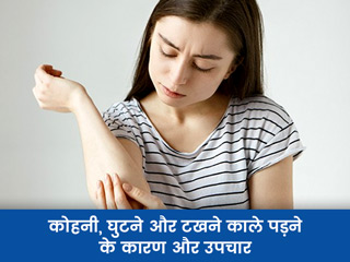 कोहनी, घुटने और टखने की त्वचा पड़ गई है काली? त्वचा रोग विशेषज्ञ से जानें इसका कारण और उपचार