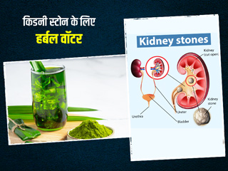 किडनी में पथरी का रामबाण उपाय है ये हर्बल वॉटर, एक्सपर्ट से जानें रेसिपी
