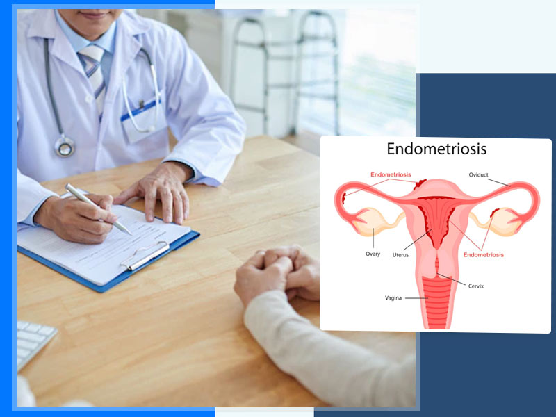 Can Endometriosis Be Treated? These Are Treatment Options for Endometriosis