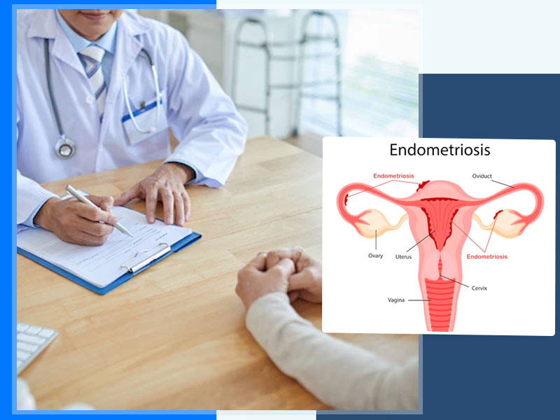 Treatment for Endometriosis to get Pregnant - Raadina Health