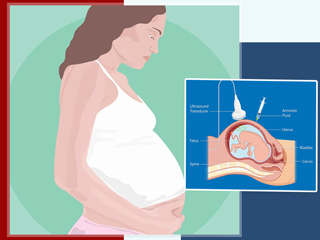 होने वाले बच्चे में जेनेटिक बीमारी का पता लगाने के लिए प्रेगनेंसी में करवाएं CVS Test, जानें इसके बारे में 