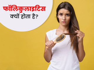 फॉलिकुलाइटिस बन सकता है हेयर फॉल का कारण, जानें इसके कारण, लक्षण और इलाज