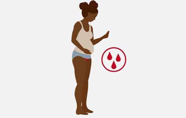 bleeding-during-pregnancy-symptoms-causes-treatment-onlymyhealth