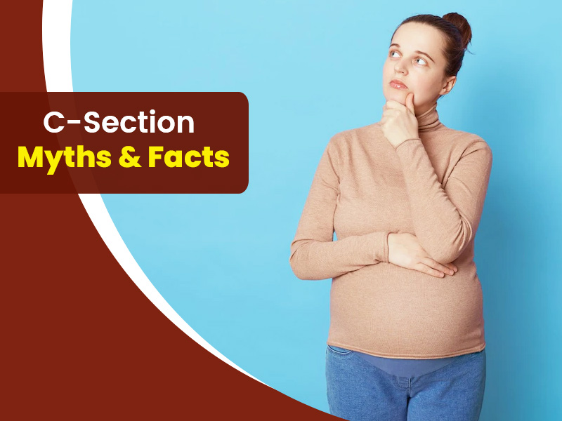 10 Common C-Section Delivery Myths Debunked: The Realities Of The