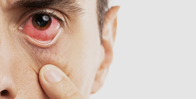 pink eye tips