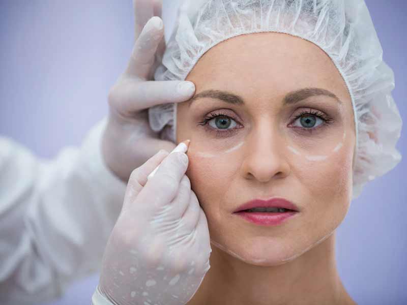 Plastic Surgery 101: Know Everything Related To This Surgical Method