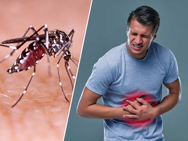 डेंगू में पेट दर्द क्यों होता है? जानें इसके कारण और बचाव के उपाय