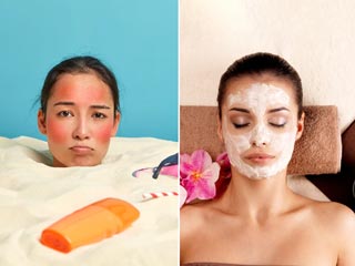 स्किन को D-Tan करने के लिए आजमाएं ये 5 आसान घरेलू उपाय, त्वचा में आएगा निखार