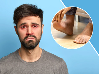चेहरे और पैरों पर क्यों आती है सूजन? जानें कारण और इसे दूर करने के घरेलू टिप्स