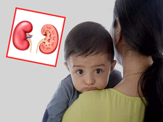 शिशुओं में किडनी से जुड़ी गंभीर बीमारी है हाइड्रोनेफ्रोसिस, डॉक्टर से जानें इसके लक्षण, कारण इलाज