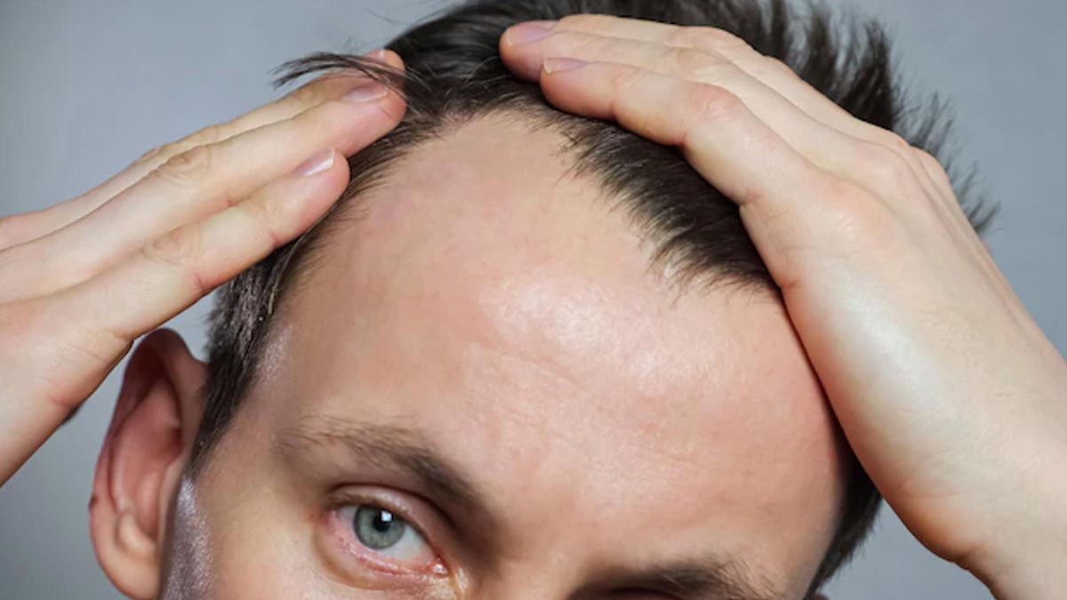 Hair-Oiling-To-Reduce-Bald-Spot
