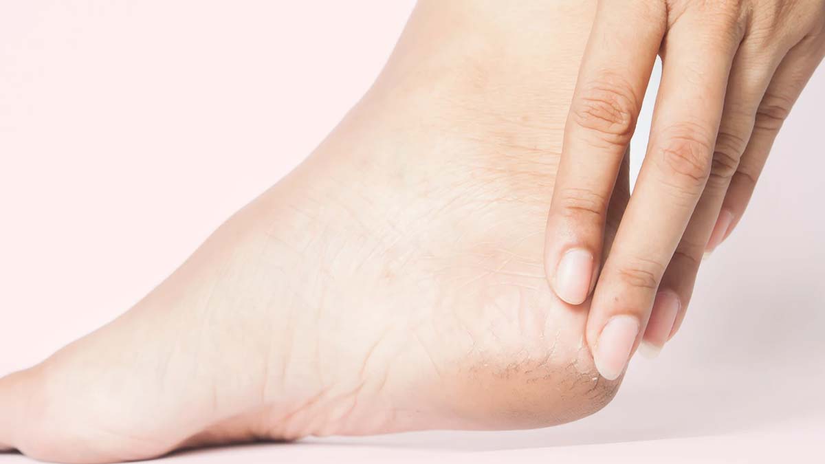 Litchi Peel Benefits For Skin IN Hindi