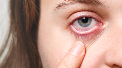 क्या आपकी आंखें अंदर की तरफ धंसने लगी हैं? इन चीजों को खाने से दूर होगी ये समस्या