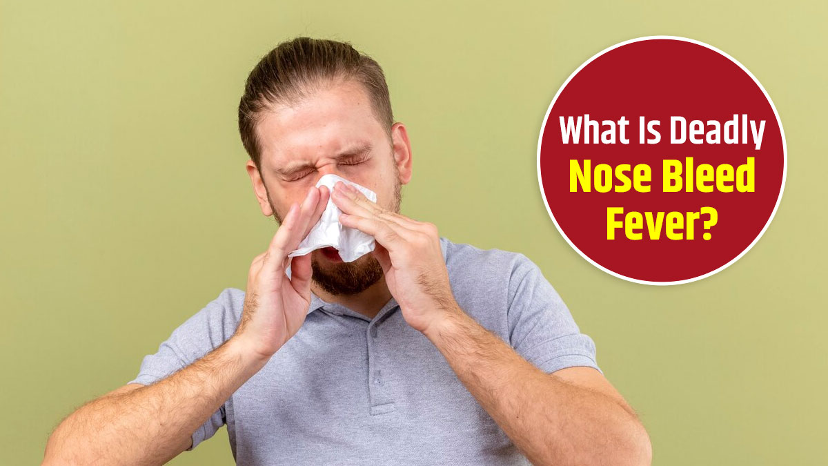 Nosebleed Fever Outbreak in Iraq: Check All Details Here | OnlyMyHealth