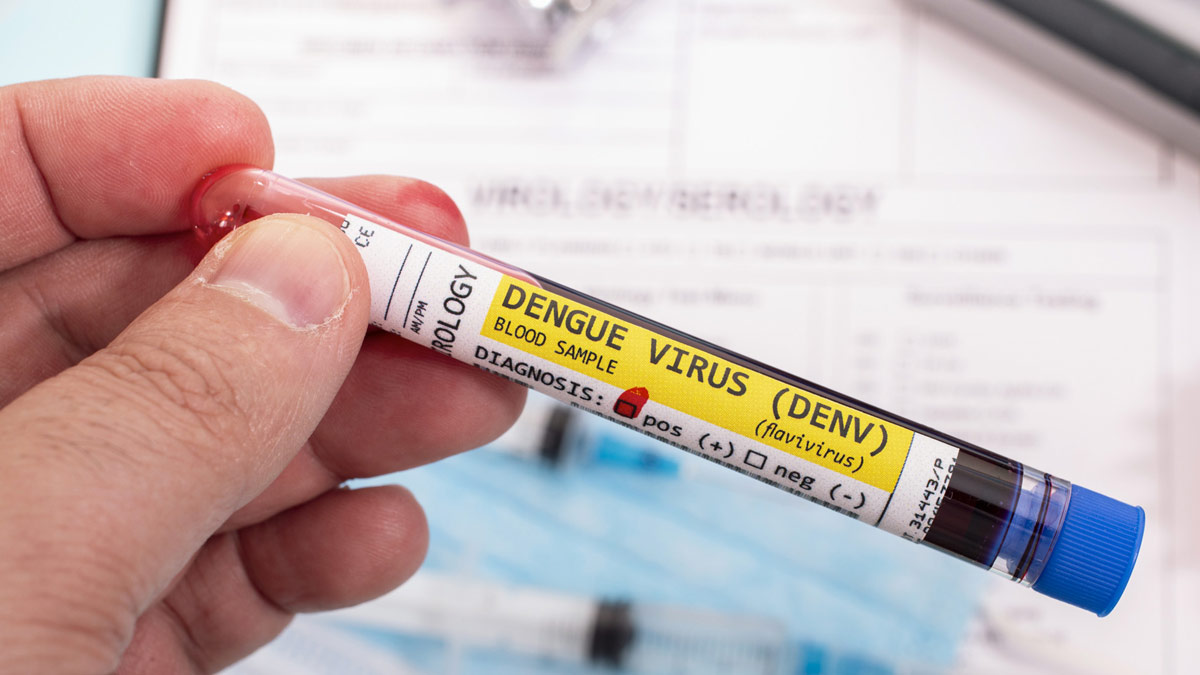 IgM and IgG Antibody Testing in Diagnosing Dengue, All You Need To Know