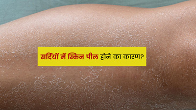सर्दियों की शुरुआत में स्किन की पर्त क्यों निकलने लगती है? जानें कारण और बचाव के उपाय
