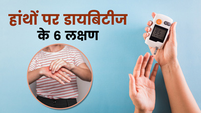 हाथों में दिखाई देते हैं डायबिटीज के ये 6 लक्षण, न करें नजरअंदाज
