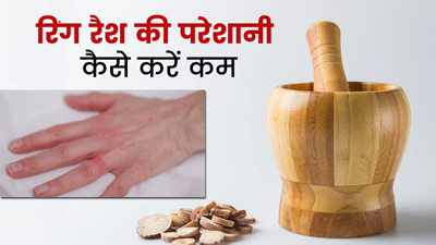 अंगूठी पहने से हो गई है रैशेज की समस्या? इन उपायों से पाएं छुटकारा