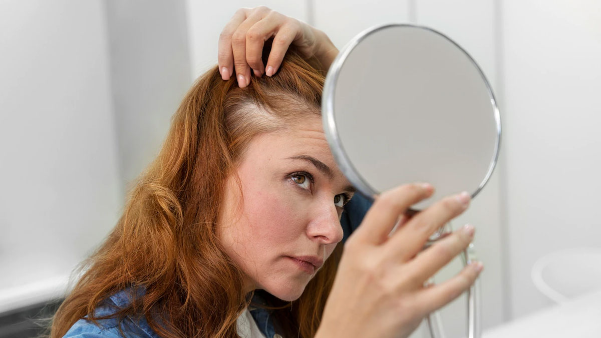 Oily Scalp Ayurvedic Tips