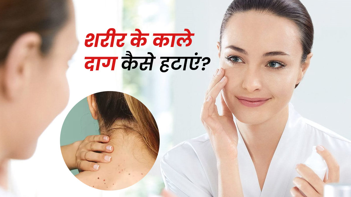 शरीर से काले दाग हटाने के लिए अपनाएं ये 5 घरेलू उपाय how to remove