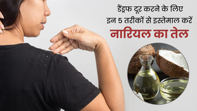 डैंड्रफ से छुटकारा पाने के लिए इन 5 तरीकों से इस्तेमाल करें नारियल तेल