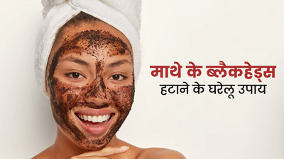 माथे के जिद्दी ब्लैकहेड्स से हैं परेशान? इन आसान उपायों से पाएं छुटकारा