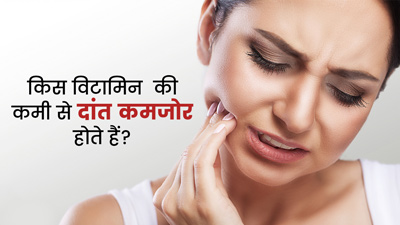 किस विटामिन की कमी से दांत कमजोर होते हैं? जानें कैसे करें इसकी कमी पूरी