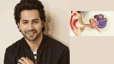 एक्टर वरुण धवन हो गए थे Vestibular Hypofunction का शिकार, जानें इस रोग के कारण और लक्षण