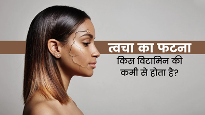 किस विटामिन की कमी से स्किन फटती है? जानें इसके महत्वपूर्ण स्त्रोत