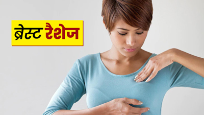 रैशेज के कारण ब्रेस्‍ट में होती है खुजली? जानें इसके लिए 5 घरेलू उपाय