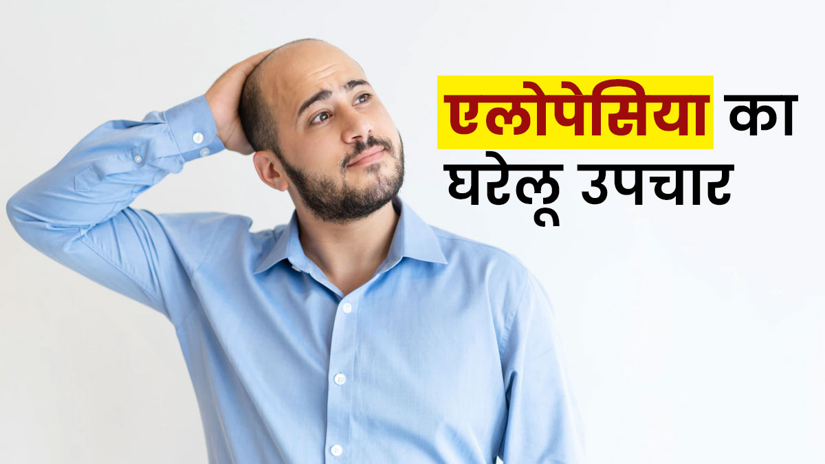 गुच्छों में बाल झड़ने (एलोपेसिया एरीटा) की समस्या के लिए घरेलू उपाय