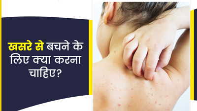 खसरे से बचने के लिए क्या करना चाहिए? जानें डाइट और लाइफस्टाइल से जुड़ी सावधानियां