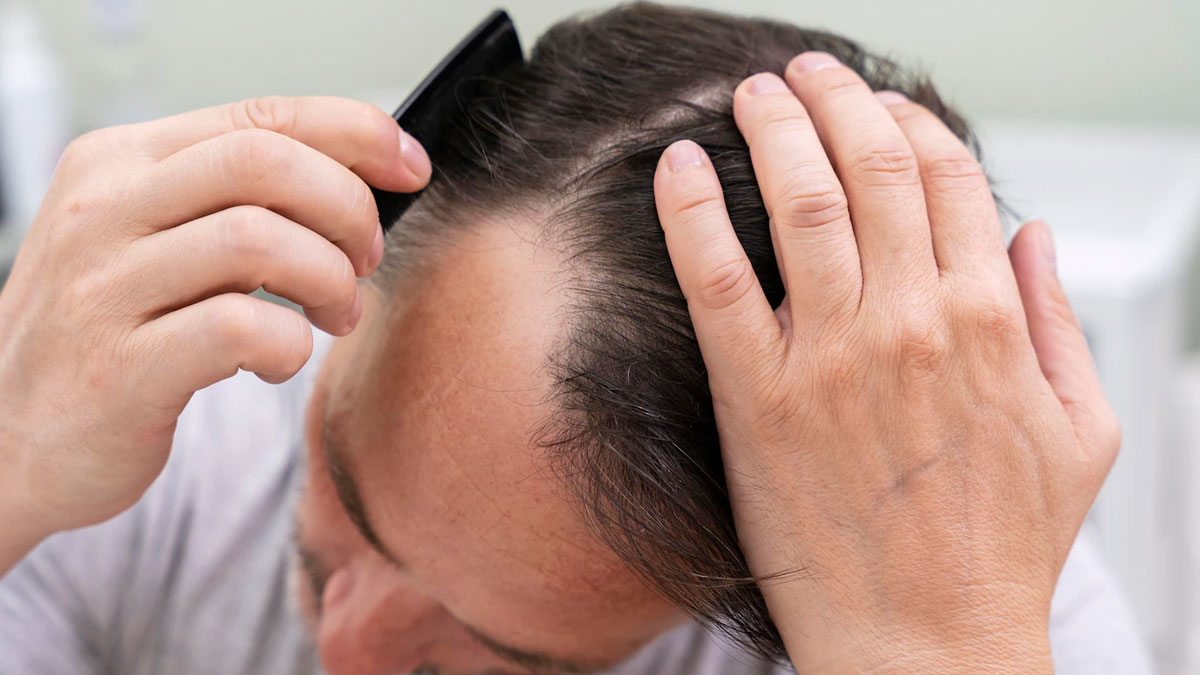 Mustard Oil For Baldness