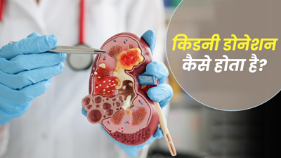 किडनी डोनेशन कैसे होता है? जानें किडनी डोनेशन से जुड़ी जरूरी बातें और सावधानियां