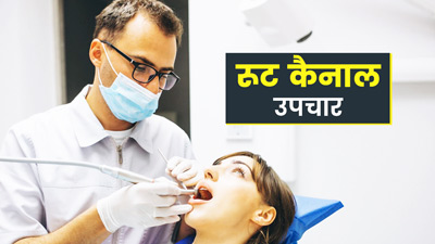 रूट कैनाल के बाद क‍ौन सी सावधान‍ियां बरतनी हैं जरूरी? जानें डॉक्‍टर से
