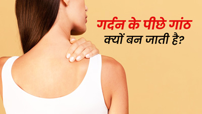 गर्दन के पीछे गांठ क्यों बन जाती है? जानें इसके 5 कारण