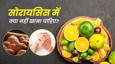 सोरायसिस के मरीज न करें इन 7 चीजों का सेवन, बढ़ सकती है परेशानी