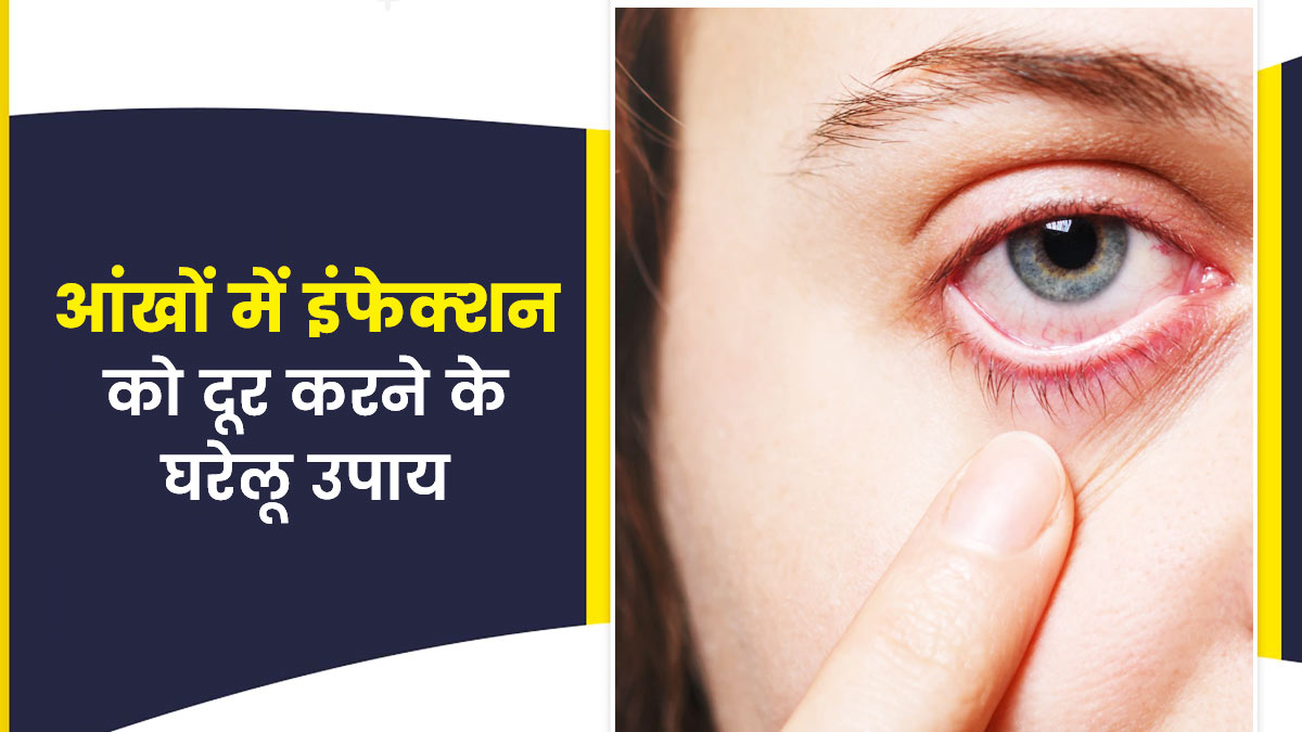 आंखों के इंफेक्शन को ठीक करने के लिए अपनाएं ये घरेलू उपाय